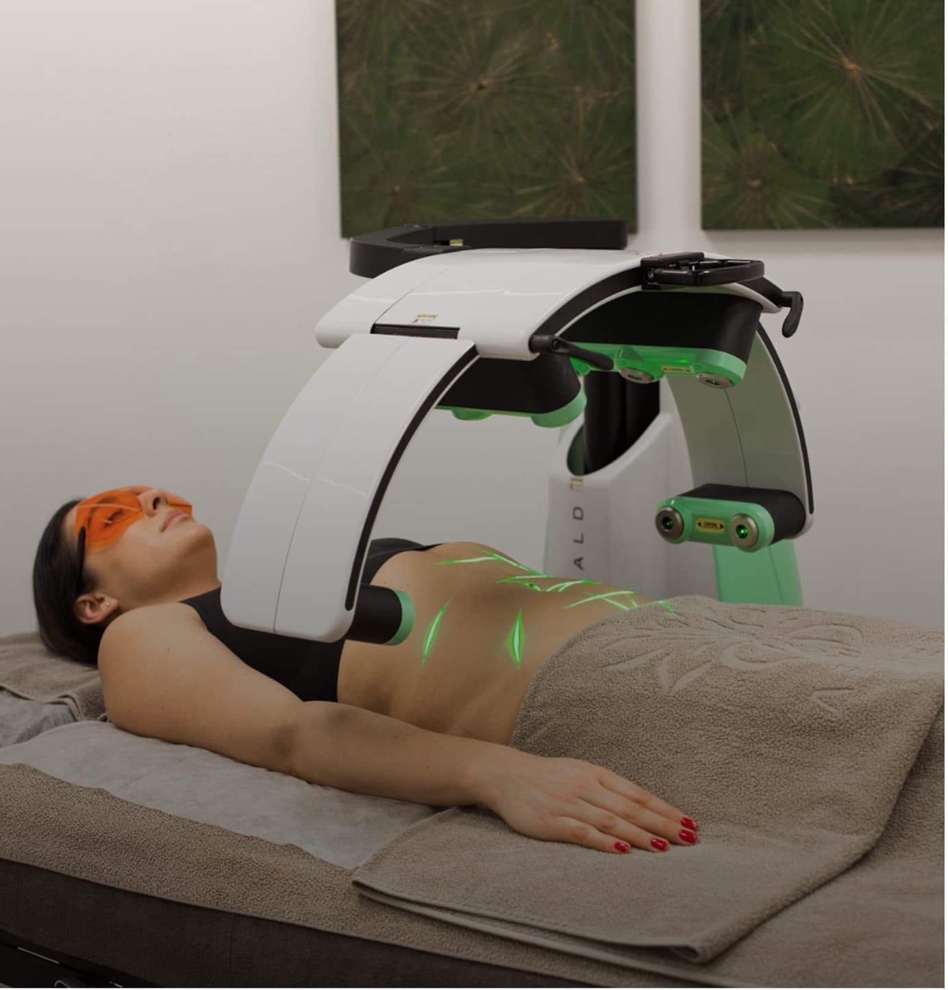 Emerald® Laser